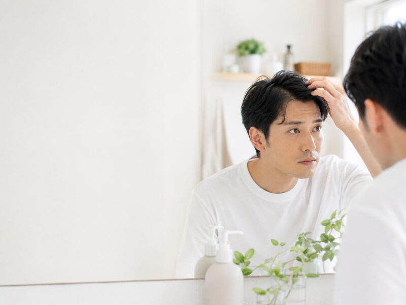 AGAの初期症状とは？相談の目安を解説