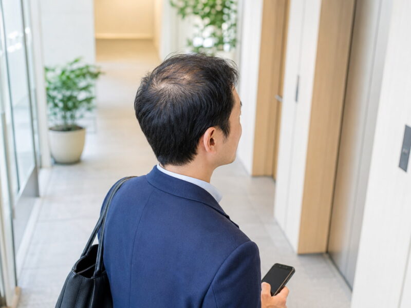 側頭部は残っているのに上だけ薄いのはなぜ？
