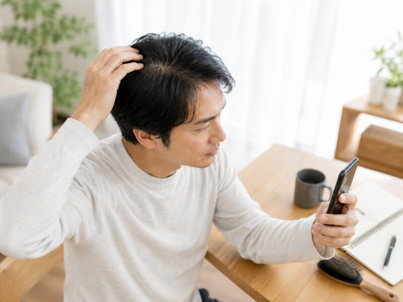 写真で頭頂部が薄く見えたときに確認すること