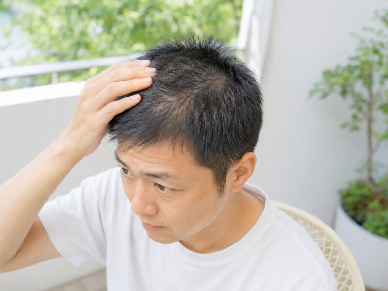 短髪にしたら頭皮が透ける男性へ